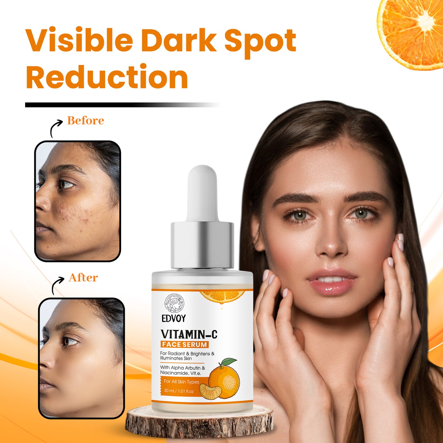 EDVOY Vitamin C face serum with Alpha Arbutin, Niacinamide & Hyaluronic Acid | Skin Brightening & Hydration | For All Skin Types (30 ml)