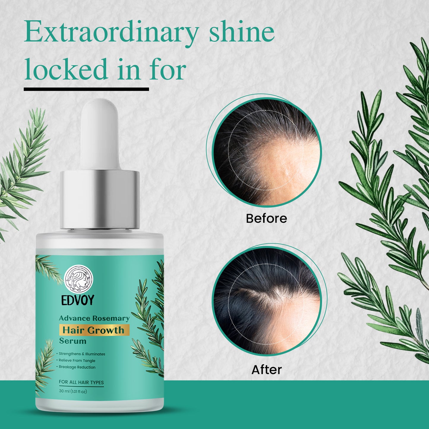 EDVOY Rosemary Advanced Hair Growth Serum With Amla,Bhringraj | Reduces Hair Fall | 30ML